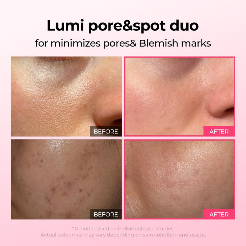 Avura Lumi Pore & Spot Care