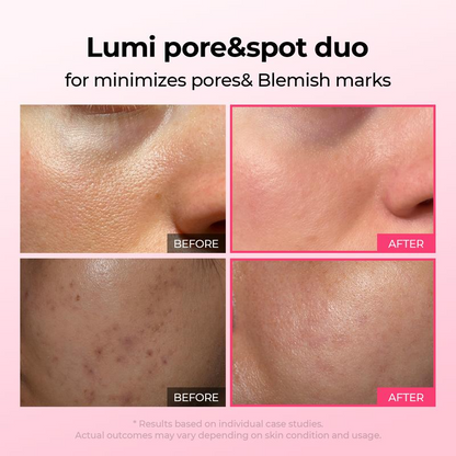 Avura Lumi Pore & Spot Care
