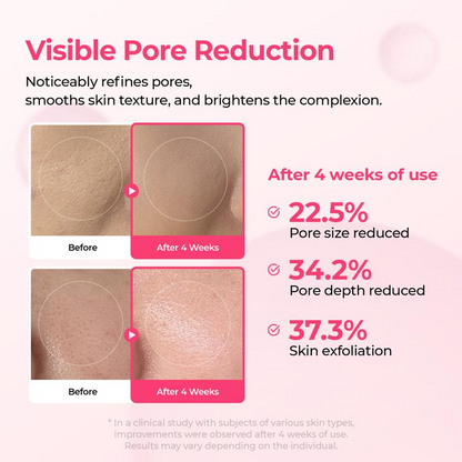 Avura Lumi Pore & Spot Care