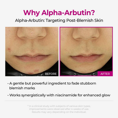 Avura Lumi Pore & Spot Care